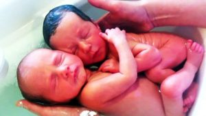 Τα δίδυμα που δεν κατάλαβαν ότι γεννήθηκαν και έμειναν για ώρα αγκαλιασμένα όπως μέσα στην κοιλιά της μαμάς τους!