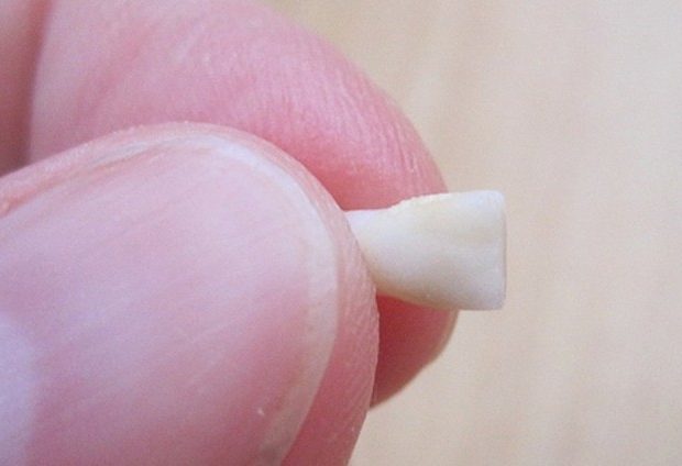 Οι Οδοντίατροι Προειδοποιούν: ΜΗΝ Πετάτε τα Δόντια που Αλλάζει το Παιδάκι σας. Ο Λόγος; Πολύτιμος!