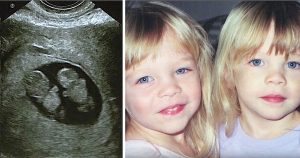 Μια μητέρα γέννησε πανομοιότυπα δίδυμα. 12 χρόνια μετά, βρίσκει το ένα να συμπεριφέρεται παράξενα στο πάτωμα του μπάνιου.