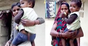 Παιδί στην Ινδία με 30 εκατοστά ουρά λατρεύεται ως μετενσάρκωση του Θεού της μαϊμούς