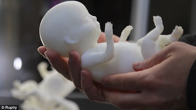 Νέα τεχνολογία επιτρέπει την τρισδιάστατη εκτύπωση μοντέλου ενός αγέννητου παιδιού