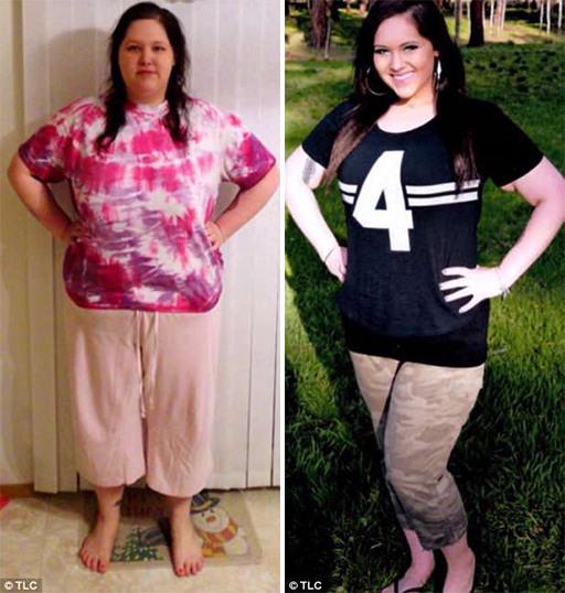 Γυναίκα που έχασε 148 κιλά θέλει απεγνωσμένα να ξεφορτωθεί το περισσευούμενο δέρμα της