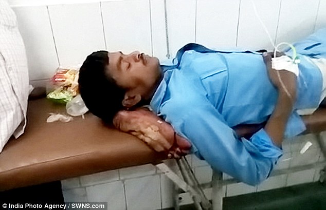 Ινδός χρησιμοποιεί το ακρωτηριασμένο πόδι του σαν μαξιλάρι μετά από ατύχημα