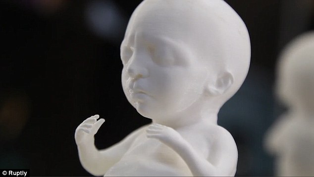 Νέα τεχνολογία επιτρέπει την τρισδιάστατη εκτύπωση μοντέλου ενός αγέννητου παιδιού
