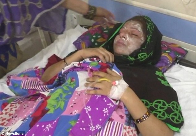 Ινδός έριξε οξύ στο πρόσωπο της γυναίκας του επειδή γέννησε κορίτσι και όχι αγόρι