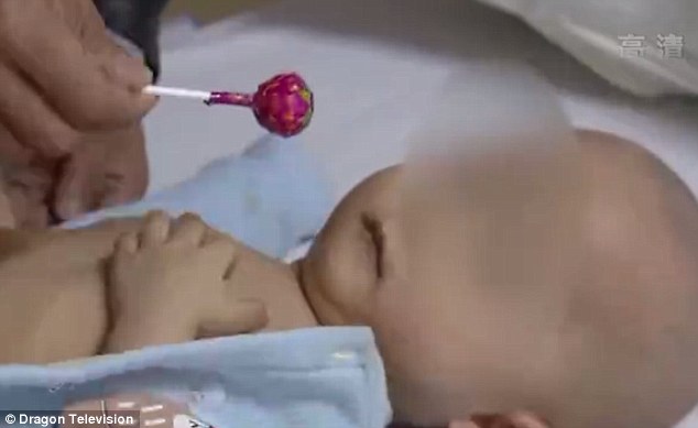 Μωρό στην Κίνα γεννήθηκε με 3 πόδια