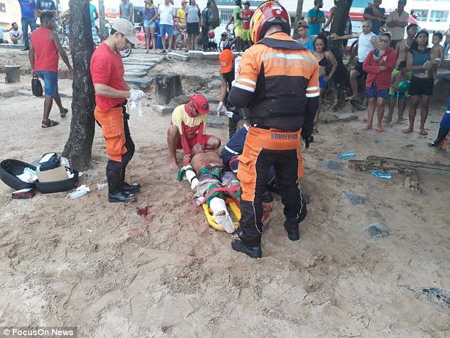 Toυρίστας έχασε το ένα πόδι του μετά από επίθεση καρχαρία στην Βραζιλία