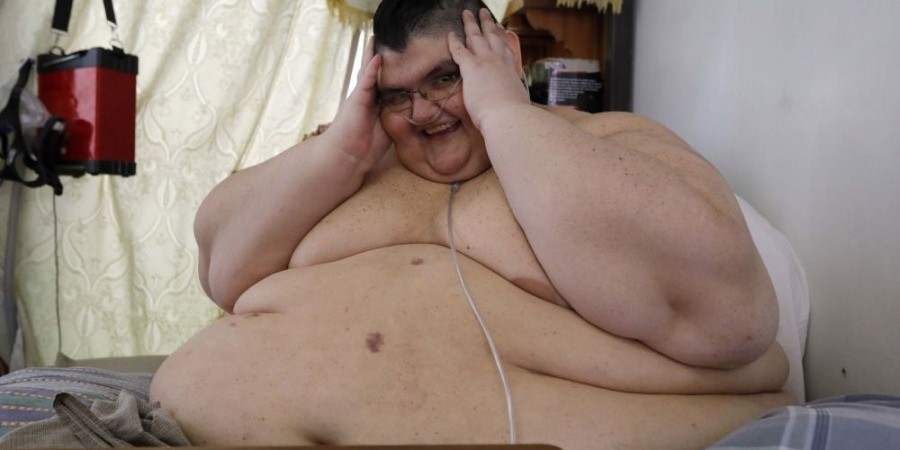 Ο πιο βαρύς άνθρωπος στον κόσμο έχασε 334 κιλά