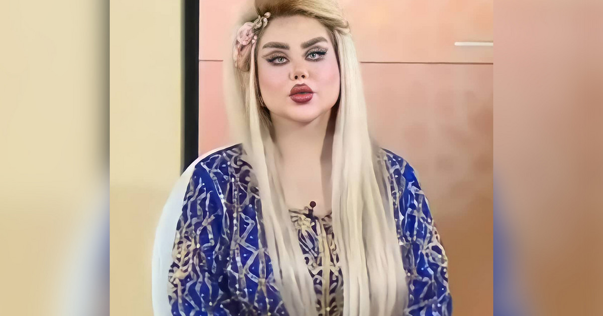 Ιρακινή παρουσιάστρια έκανε 43 πλαστικές για να γίνει «Barbie» και λένε πως μοιάζει με «ζόμπι»